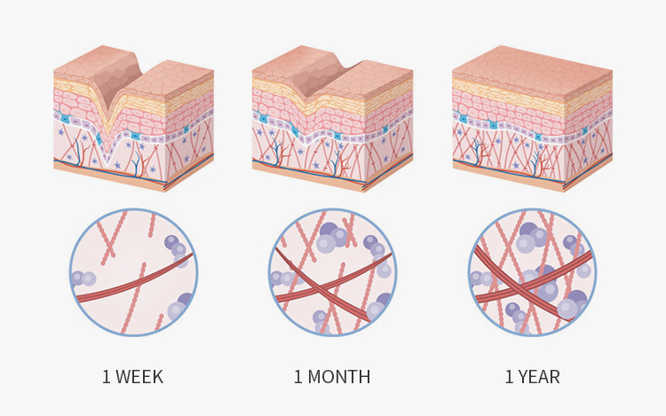 fun&ccedil;&atilde;o-de-LED-beleza